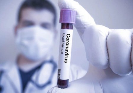 Azərbaycanda daha iki nəfər koronavirusdan öldü:  yeni yoluxma faktı artdir - RƏSMİ