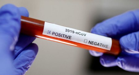 Azərbaycanda daha 314 nəfərdə koronavirus aşkarlandı