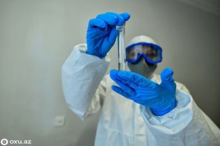 Azərbaycanda daha 438 nəfərdə koronavirus aşkarlandı, dörd nəfər vəfat etdi