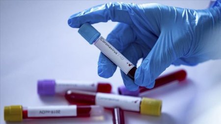 Azərbaycanda son sutkada 283 nəfər koronavirusdan sağaldı